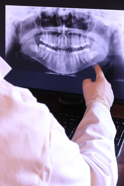 Best Emergency Dental Surgery in Burt, MI