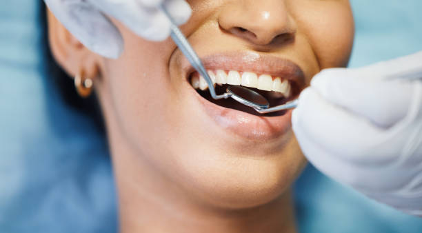 Best After-Hours Emergency Dentist in Burt, MI