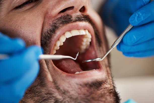Best 24-Hour Emergency Dentist in Burt, MI